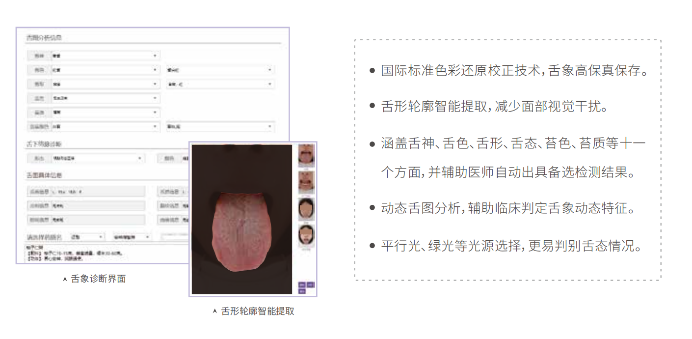 中醫(yī)舌診儀（舌象信息采集管理系統(tǒng)）MT-SX-02舌象分析特點.png